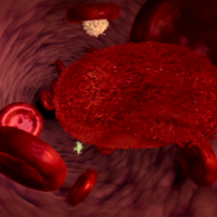 Blutkörperchen - Was ist Blutkrebs